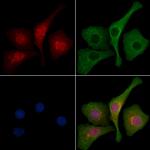 LZTR1 Polyclonal Antibody