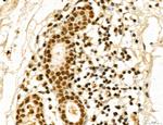 MACC1 Polyclonal Antibody