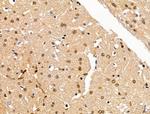 H2AFY2 Antibody in Immunohistochemistry (Paraffin) (IHC (P))
