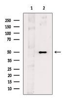 MAGEA4 Antibody in Western Blot (WB)