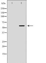 Monoamine Oxidase B Antibody in Western Blot (WB)