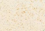 TPL2 Antibody in Immunohistochemistry (Paraffin) (IHC (P))