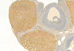 TPL2 Antibody in Immunohistochemistry (Paraffin) (IHC (P))