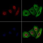 MAPKAPK2 Polyclonal Antibody