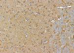 MARCH8 Polyclonal Antibody