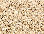 MARS Antibody in Immunohistochemistry (Paraffin) (IHC (P))