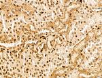 MARS Antibody in Immunohistochemistry (Paraffin) (IHC (P))