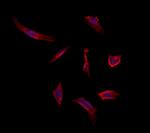 MAT1A Polyclonal Antibody