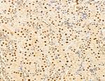 MAT2A Antibody in Immunohistochemistry (Paraffin) (IHC (P))