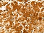 MAT2A Polyclonal Antibody