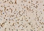 MCM7 Antibody in Immunohistochemistry (Paraffin) (IHC (P))