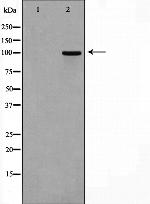 CSF1R Polyclonal Antibody