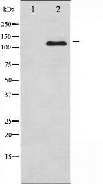 CSF1R Polyclonal Antibody
