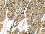 MDC1 Polyclonal Antibody