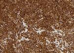 EVI1 Antibody in Immunohistochemistry (Paraffin) (IHC (P))