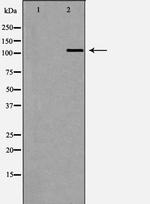 EVI1 Antibody in Western Blot (WB)