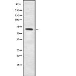 ME2 Antibody in Western Blot (WB)