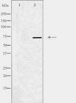 MED17 Polyclonal Antibody