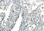MED31 Polyclonal Antibody