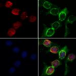 MEF2C Polyclonal Antibody