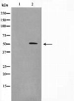Menin Polyclonal Antibody