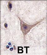CDH10 Polyclonal Antibody