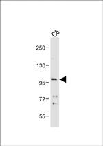 CDH10 Antibody in Western Blot (WB)