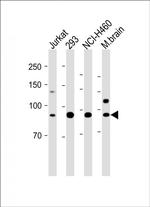 CDH10 Antibody in Western Blot (WB)