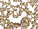 METTL1 Antibody in Immunohistochemistry (Paraffin) (IHC (P))