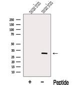 METTL1 Antibody in Western Blot (WB)