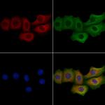 MFAP5 Polyclonal Antibody