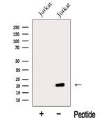 MFAP5 Antibody in Western Blot (WB)