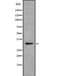 MGLL Antibody in Western Blot (WB)