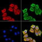 MGLL Polyclonal Antibody