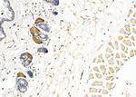 MGLL Antibody in Immunohistochemistry (Paraffin) (IHC (P))
