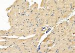 MGLL Antibody in Immunohistochemistry (Paraffin) (IHC (P))