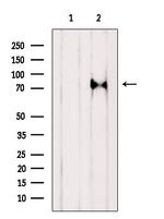 mGluR7 Antibody in Western Blot (WB)