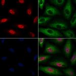 KMT2D Polyclonal Antibody