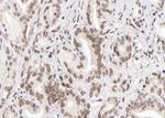 KMT2D Antibody in Immunohistochemistry (Paraffin) (IHC (P))