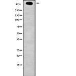 KMT2D Antibody in Western Blot (WB)
