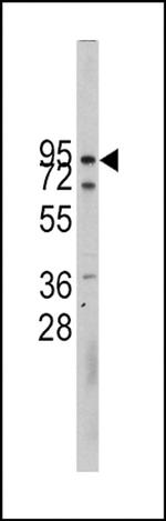 CDH10 Antibody in Western Blot (WB)