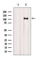 CASC3 Polyclonal Antibody