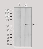 MMP1 Antibody in Western Blot (WB)