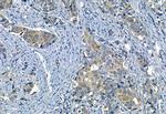 MMP2 Antibody in Immunohistochemistry (Paraffin) (IHC (P))