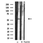 MNK1 Polyclonal Antibody