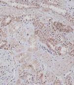 CD9 Antibody in Immunohistochemistry (Paraffin) (IHC (P))