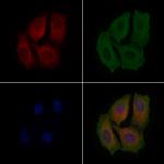 MRPL19 Polyclonal Antibody