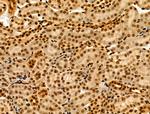MTA1 Polyclonal Antibody