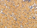 MTR Polyclonal Antibody
