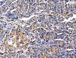 MUM1 Antibody in Immunohistochemistry (Paraffin) (IHC (P))